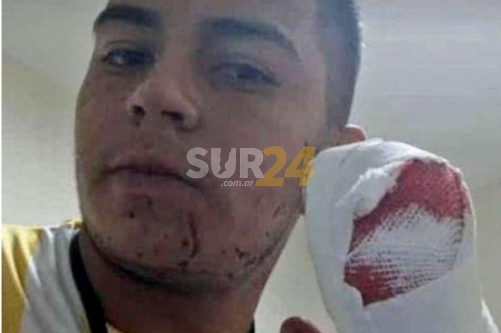 Tucumán: con un machete le cortaron cuatro dedos a un delivery para robarle