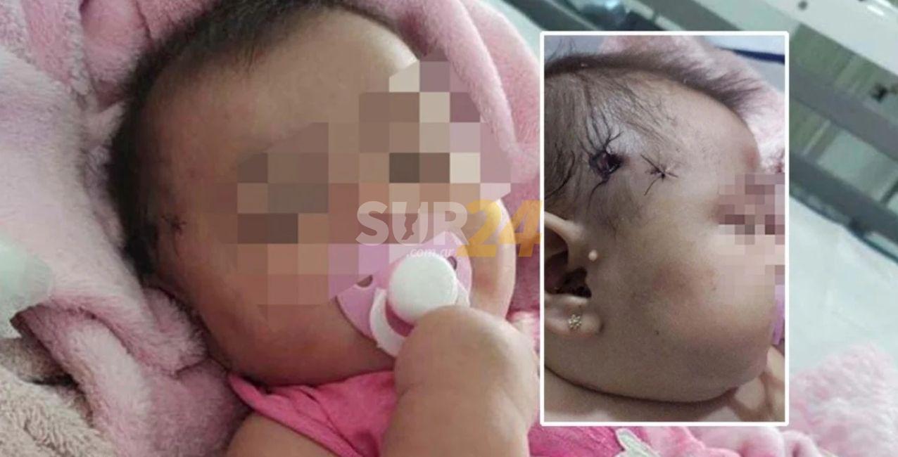Durante una persecución policial, una beba recibió un balazo de goma