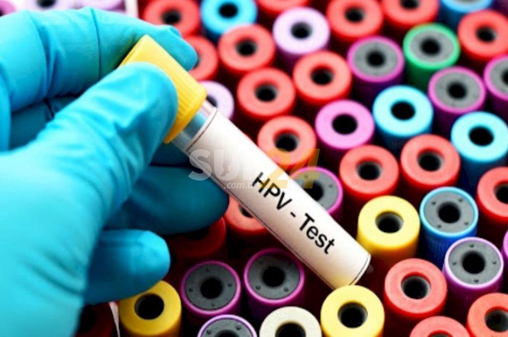 Un test permitirá detectar en forma directa la presencia de virus de papiloma humano
