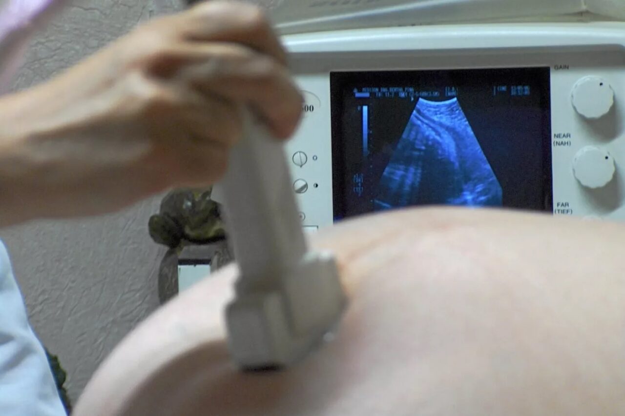 El hospital de Venado realiza más de cinco abortos por mes