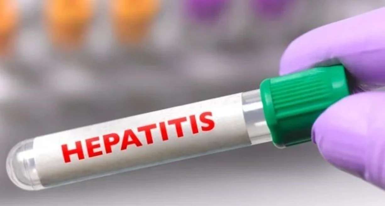 Confirman la causa de los brotes de hepatitis infantil aguda de origen desconocido
