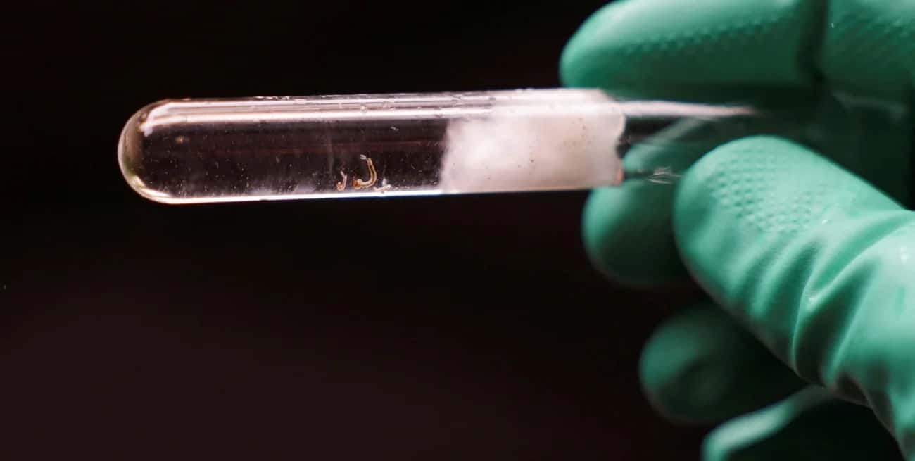 Larvas de mosquito durante una inspección. Créditos: Reuters