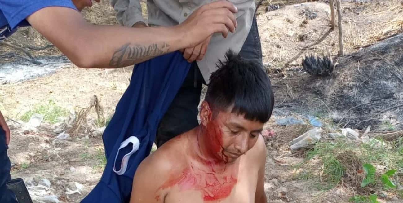 González Catán: muertos y heridos en enfrentamiento por terrenos
