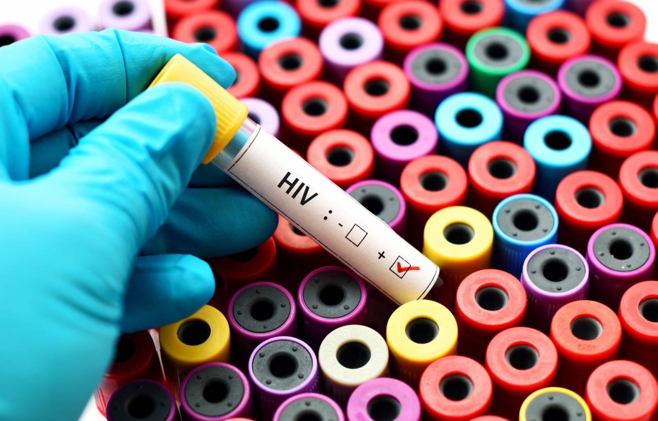 Confirman el tercer caso de curación de VIH del mundo